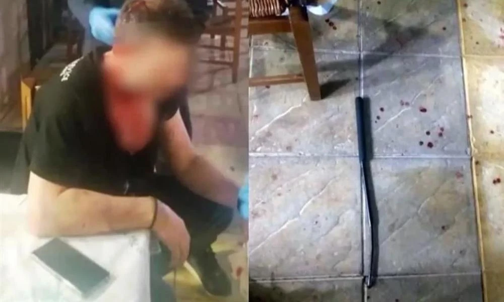 Αγρίνιο: «Μου άνοιξαν το κεφάλι, έχω 12 ράμματα», λέει ο εστιάτορας που ξυλοκοπήθηκε από 3 Ρομά (Βίντεο)